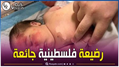 صورة فيديو متداول لرضيعة فلسطينية جائعة توفيت والدتها في قصف صهيوني!